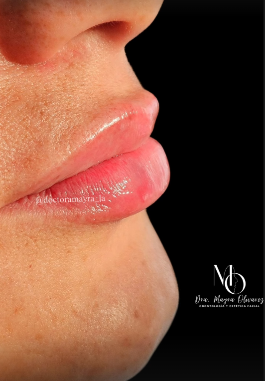 Armonización labial
